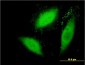 SGK2 Antibody (monoclonal) (M09)