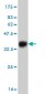 SGK2 Antibody (monoclonal) (M09)