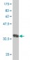 SH2B Antibody (monoclonal) (M01)