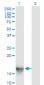 SH2D1A Antibody (monoclonal) (M01)