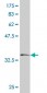 SH3BP4 Antibody (monoclonal) (M11)