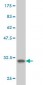 SH3GL2 Antibody (monoclonal) (M01)