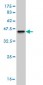 SHBG Antibody (monoclonal) (M01)