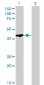 SHOX2 Antibody (monoclonal) (M01)