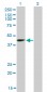 SIRT2 Antibody (monoclonal) (M01)