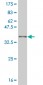 SIX3 Antibody (monoclonal) (M01)