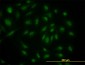 SKP1A Antibody (monoclonal) (M01)