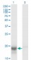 SKP1A Antibody (monoclonal) (M01)