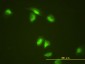 SLBP Antibody (monoclonal) (M01)