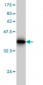 SLC11A2 Antibody (monoclonal) (M01)