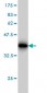 SLC11A2 Antibody (monoclonal) (M01)