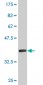 SLC12A1 Antibody (monoclonal) (M03)