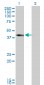 SLC12A1 Antibody (monoclonal) (M03)