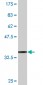 SLC1A2 Antibody (monoclonal) (M07)