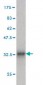 SLC25A6 Antibody (monoclonal) (M01)