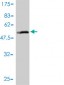 SLC27A4 Antibody (monoclonal) (M01)