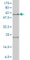 SLC27A4 Antibody (monoclonal) (M01)