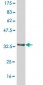 SLC2A4 Antibody (monoclonal) (M08)