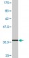 SLC36A2 Antibody (monoclonal) (M04)