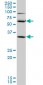 SLC36A2 Antibody (monoclonal) (M04)