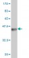 SLC4A8 Antibody (monoclonal) (M04)