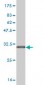 SLC5A2 Antibody (monoclonal) (M01)