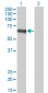 SLC5A2 Antibody (monoclonal) (M01)