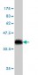 SLIT3 Antibody (monoclonal) (M04)