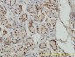 SMAD1 Antibody (monoclonal) (M02)