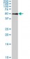 SMAD1 Antibody (monoclonal) (M03)