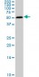 SMAD1 Antibody (monoclonal) (M03)