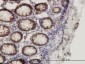 SMAD1 Antibody (monoclonal) (M03)