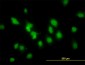 SMAD1 Antibody (monoclonal) (M03)