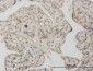 SMAD1 Antibody (monoclonal) (M04)