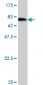 SMAD1 Antibody (monoclonal) (M04)