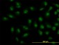 SMAD1 Antibody (monoclonal) (M04)