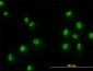 SMAD2 Antibody (monoclonal) (M01)