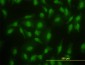 SMAD2 Antibody (monoclonal) (M05)