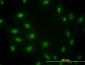 SMAD3 Antibody (monoclonal) (M09)