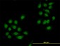 SMAD4 Antibody (monoclonal) (M01)