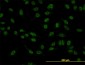 SMAD5 Antibody (monoclonal) (M01)