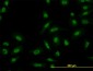 SMAD5 Antibody (monoclonal) (M03)