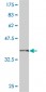 SMAD6 Antibody (monoclonal) (M08)