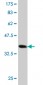 SMAD7 Antibody (monoclonal) (M05)
