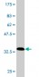 SMARCB1 Antibody (monoclonal) (M01)