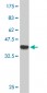 SMARCB1 Antibody (monoclonal) (M04)