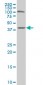 SMARCB1 Antibody (monoclonal) (M04)