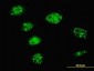 SMARCD3 Antibody (monoclonal) (M01)