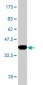 SMARCD3 Antibody (monoclonal) (M01)