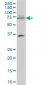 SMARCD3 Antibody (monoclonal) (M01)